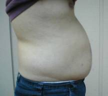 abdominal without exercise
