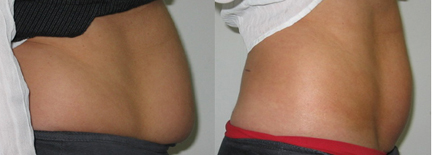 lose abs inches
