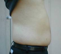 after wrap