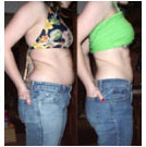 I Shrunk My Stomach Without Liposuction Read My Story Here