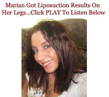 liposuction results