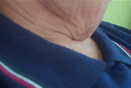 neck before lift