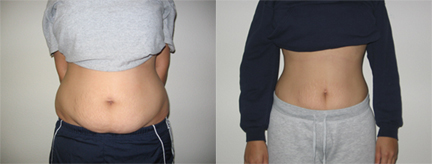 reduced stomach fat