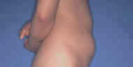 tummy before
